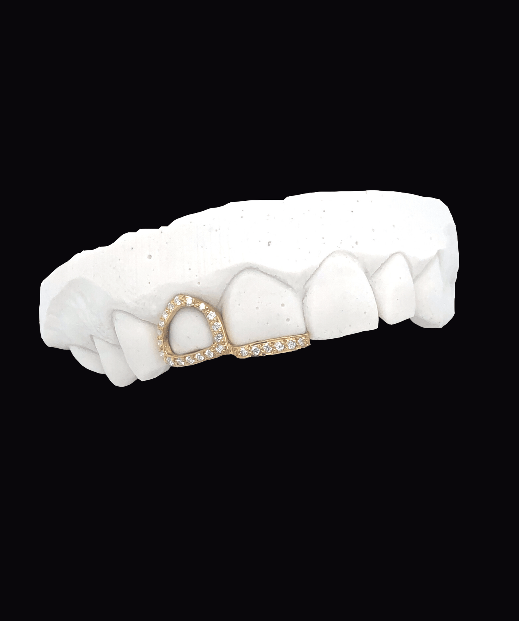 ICED London gold diamond-encrusted dental hoop on a white dental model (front view of teeth).