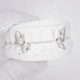 Dental model showcasing silver grillz on molars, white plaster cast, gloved hand — ICED London.