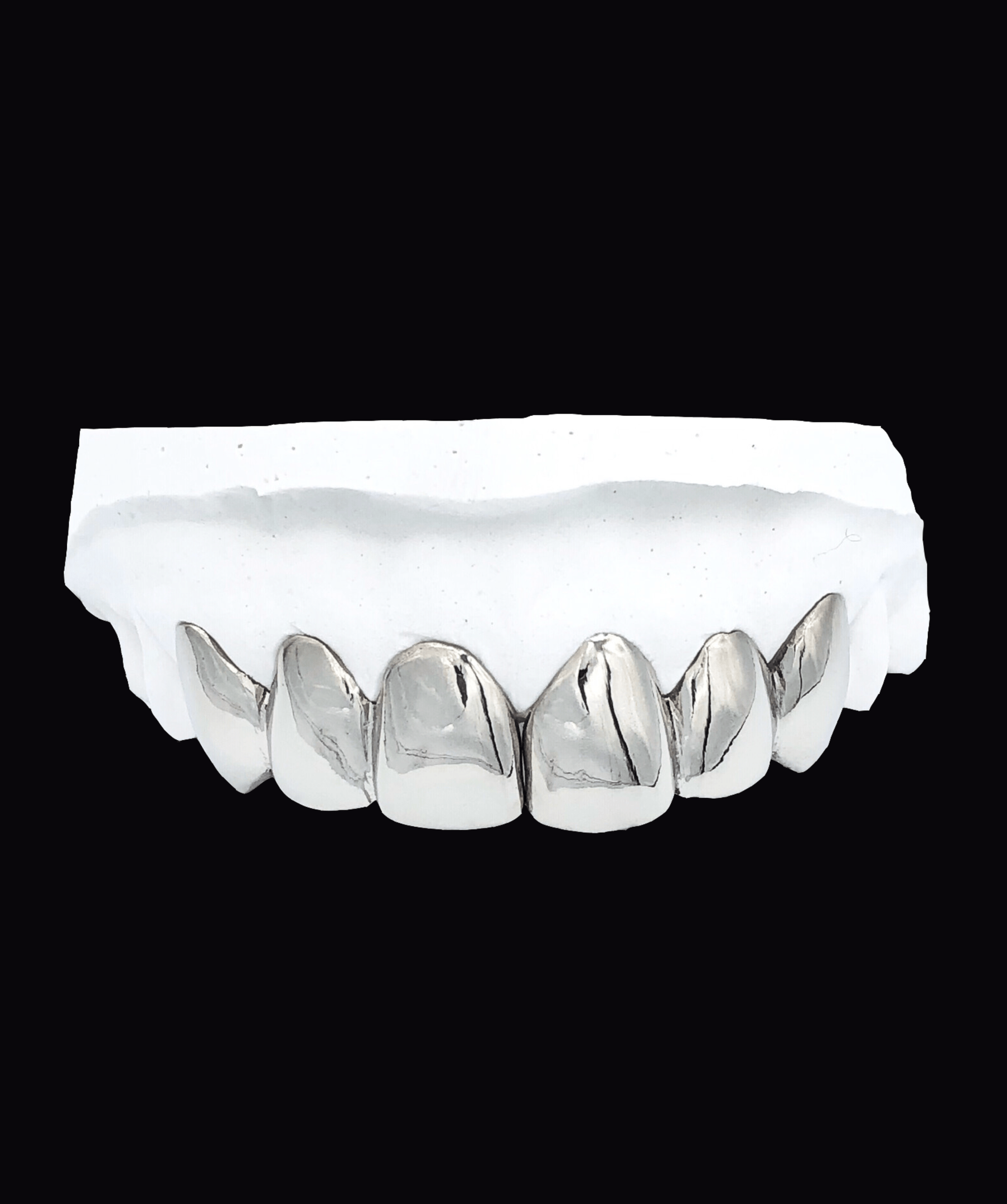 ICED London: close-up of an upper row of metallic dental crowns on a plaster dental model.