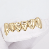 Gold-plated dental grillz set on a white dental cast, close-up studio shot. ICED London.