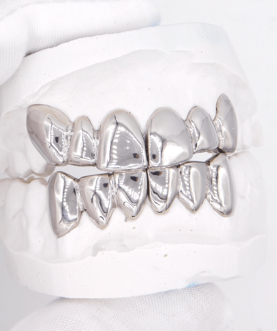 Silver dental grills (grillz) on a plaster dental model, ICED London.