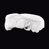 Single Gold Tooth
