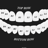 ICED London: illustration of top and bottom dental arches with labeled teeth R1–R4 and L1–L4.