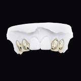Four Gold Teeth