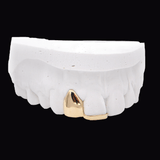 Dental model displaying a gold front crown on white teeth; ICED London.