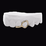 Dental model showing a gold loop clasp attached to a lower front tooth, ICED London.