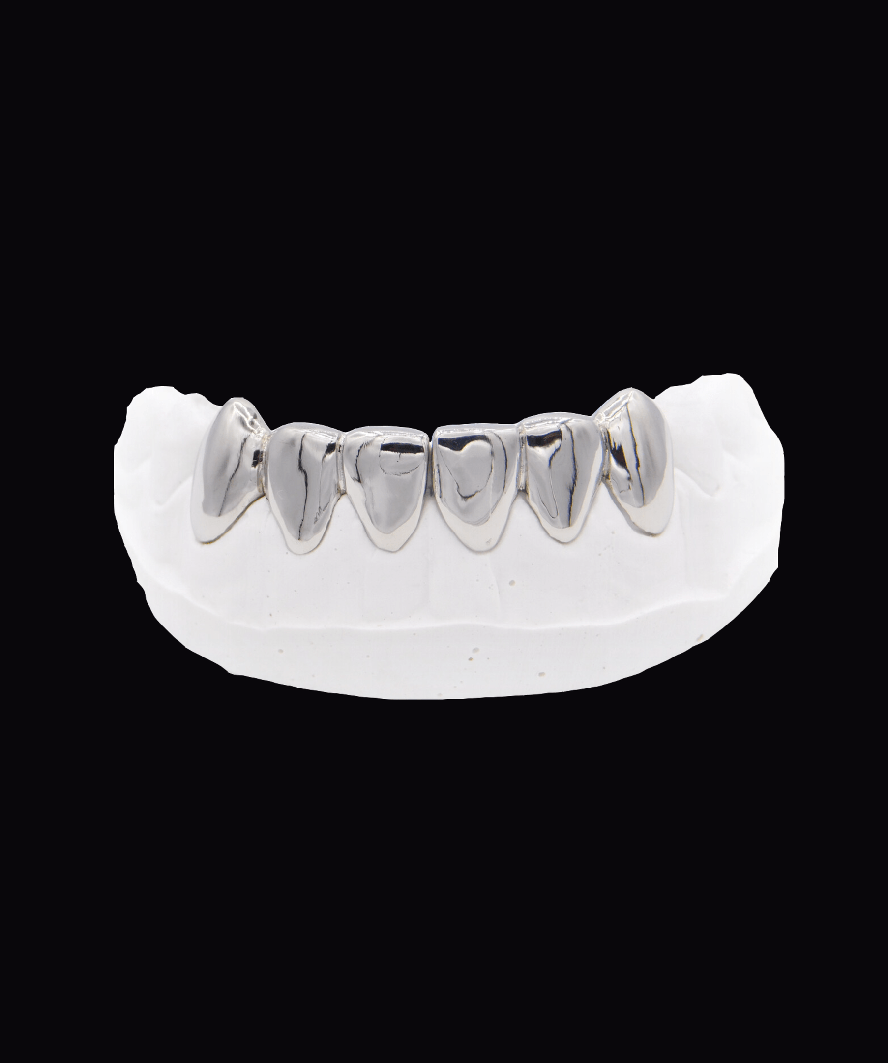 ICED London silver dental grillz on a white dental cast arch, front view.