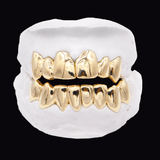 Close-up of gold grillz on a dental mold, showcasing ICED London dental jewelry.
